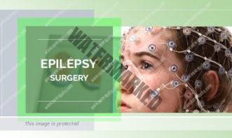 Epilepsy Surgery