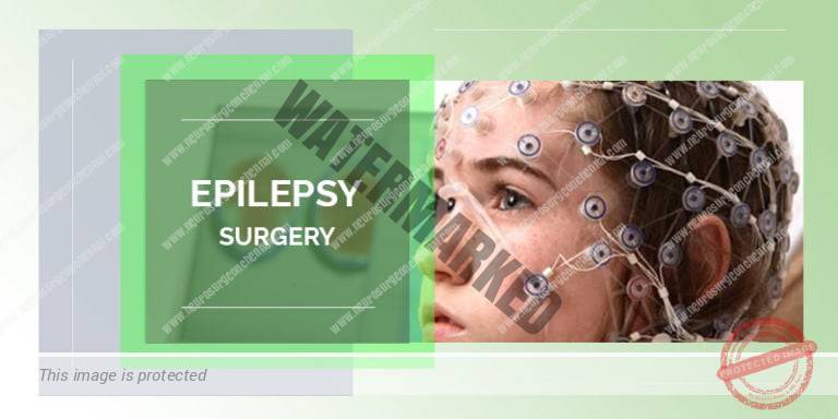 Epilepsy surgery