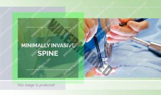 Minimally Invasive Spine