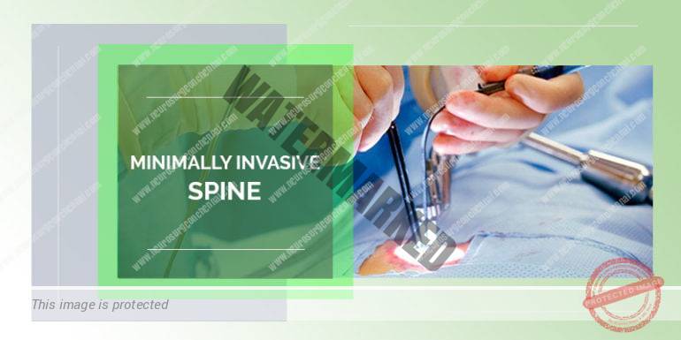 Minimally invasive spine surgery